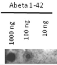 Abeta (1-42) | Amyloid-beta peptide 1-42 in the group Antibodies Human Cell Biology / Neuroscience / Neurodegenerative diseases / Alzheimer's disease at Agrisera AB (Antibodies for research) (AS08 329)